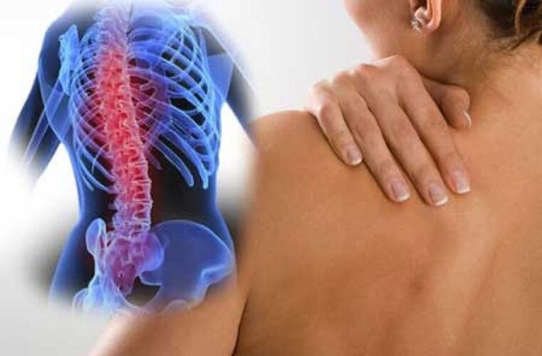 Օստեոխոնդրոզով ցավը կարող է տարածվել դեպի մարմնի հեռավոր մասեր