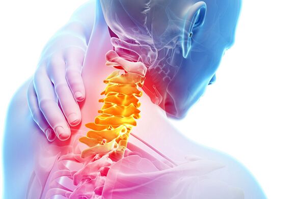 Արգանդի վզիկի օստեոխոնդրոզ